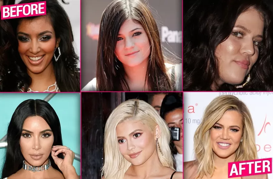 The Kardashians before and after plastic surgery. 